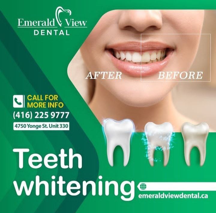 Teeth whitening/emerldviewdental