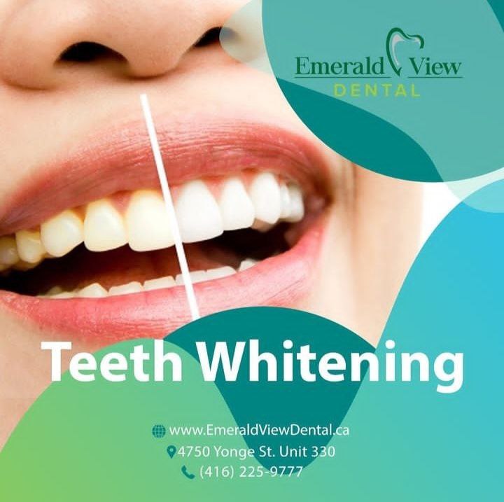 Teeth whitening/emerldviewdental
