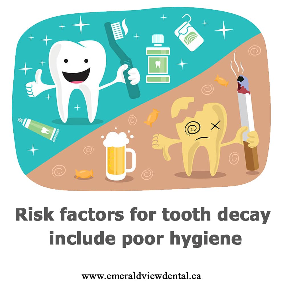 Risk Factors for tooth decay